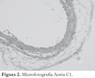 Microfotografia Aorta 