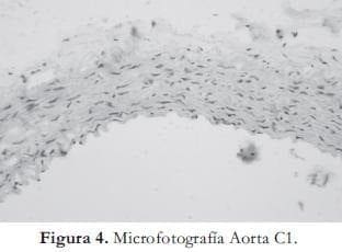 Microfotografia Aorta 