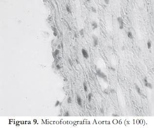 Microfotografía Aorta