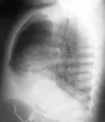 Radiografía convencionl