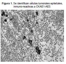Celulas umorales epiteliales