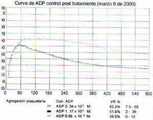 Curva de ADP control post tratamiento
