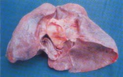 Imagen macroscópica del pulmón
