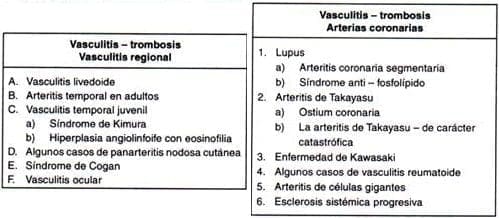 Enfermedades, Vasculitis