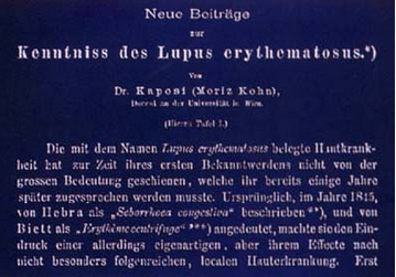 Facsímil del artículo de Kaposi publicado en 1872