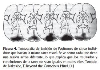 Tomografía emisión de positrones
