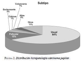 Distribución Histopatología Carcinoma Papilar