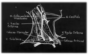 Separación lateral entre la vena y arteria
