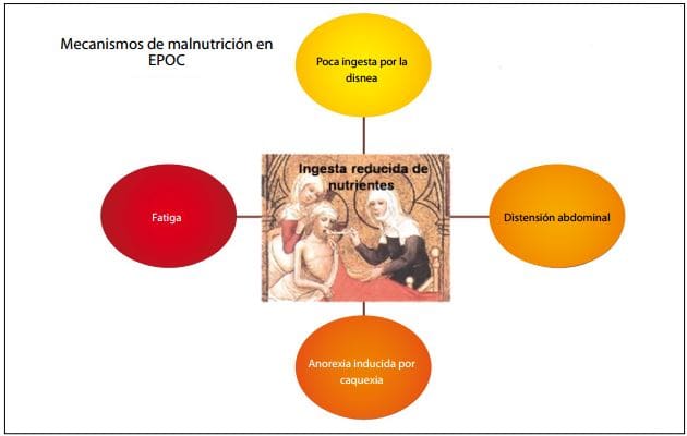 Mecanismos de malnutrición en EPOC. Ingesta reducida de nutrientes