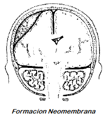 Formación de Neomembranas