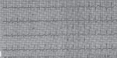 Panel B Electrocardiograma