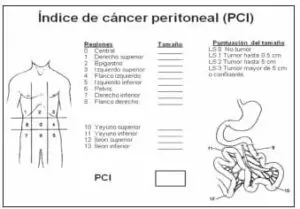Índice de Cáncer Peritoneal