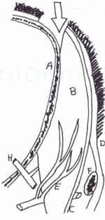 Esquema donde se muestra la relación de la vascularización y el colgajo