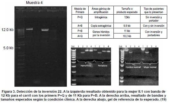 Genética Molecular, Detección de la inversión 22