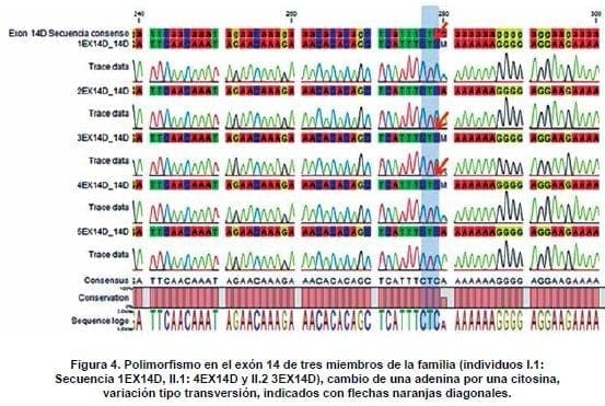 Polimorfismo en el exón 14 de tres miembros de la familia