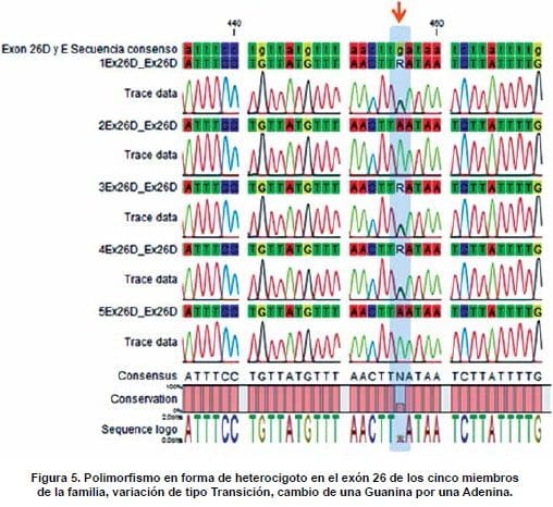 Polimorfismo en Forma de Heterocigoto en el Exón 26 