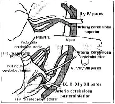 Complejos Neurovasculares