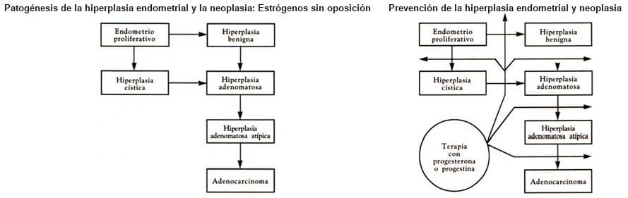 Hiperplasia Endometrial Cáncer
