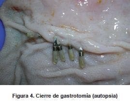 Cierre de Gastrotomía (Autopsia)