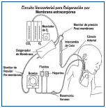 Circuito Venoarterial Utilizado para ECMO