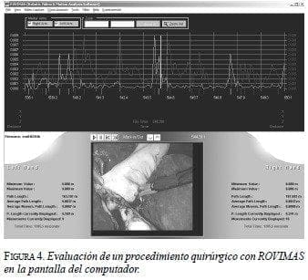 Sistema da Vinci: Evaluación de un procedimiento quirúrgico con ROVIMAS