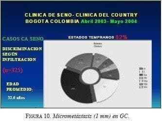 Micrometástasis (1 mm) en GC.