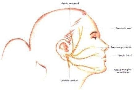 Nervio facial extracraneano