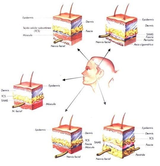 El nervio facial extracraneano