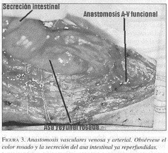 Anastomosis Vasculares Venosa y Arterial