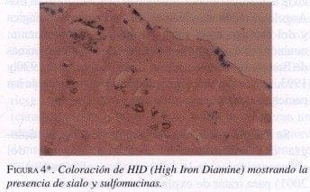 Coloración de HID (High Iron Diamine)