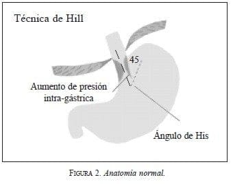 Técnica de Hill, Anatomía normal