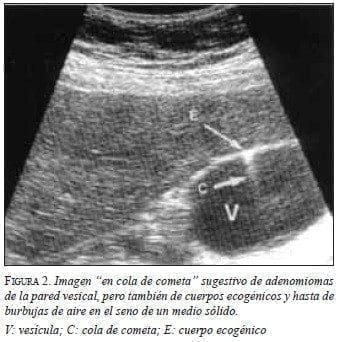 Imagen “en cola de cometa”