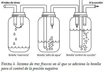 Sistema de tres frascos en el que se adiciona la botella