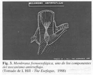 Membrana frenoesofagica