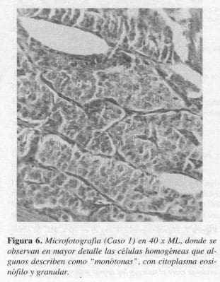 Citoplasma Eosinófilo y Granular