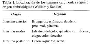 Localización de los Tumores Carcinoides