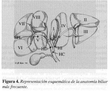 Representación Esquemática de la Anatomía Biliar más frecuente