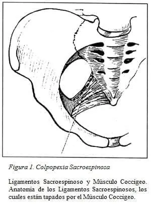 Ligamentos Sacroespinoso y Músculo Coccígeo