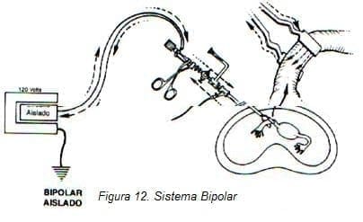 Endocirugía: Sistema Bipolar