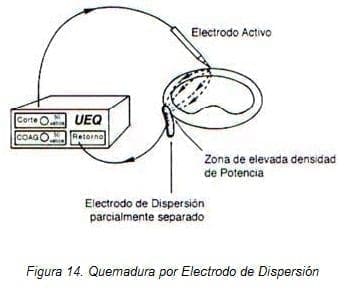 Quemadura por Electrodo de Dispersión