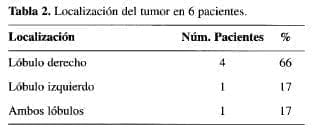 Tumores Primitivos del Hígado, Localización del tumor