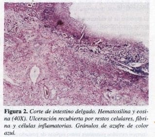 Corte de intestino delgado. Hematoxilina y Eosina