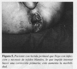 Infección y Necrosis de Tejidos Blandos