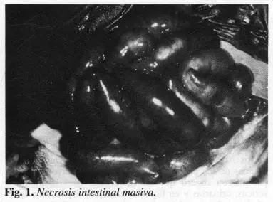 Necrosis intestinal masiva