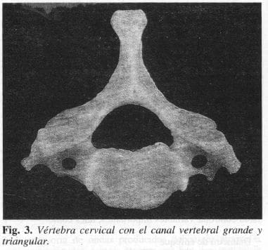 Vértebra Cervical