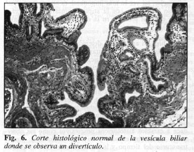 Corte Histológico Normal de la Vesícula Biliar