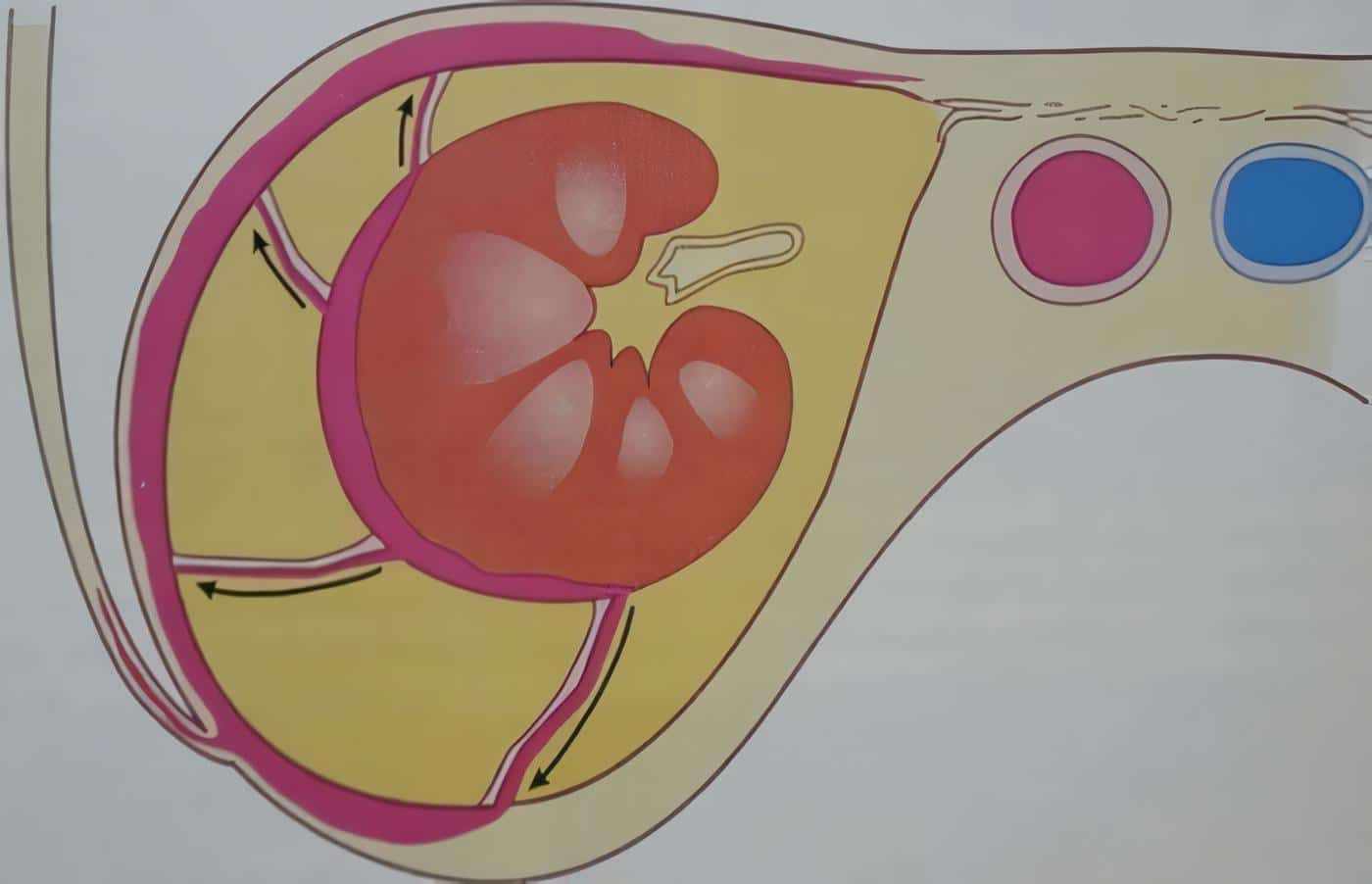 Trauma Retroperitoneal 