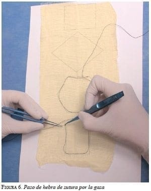 Hebra de sutura para microcirugía