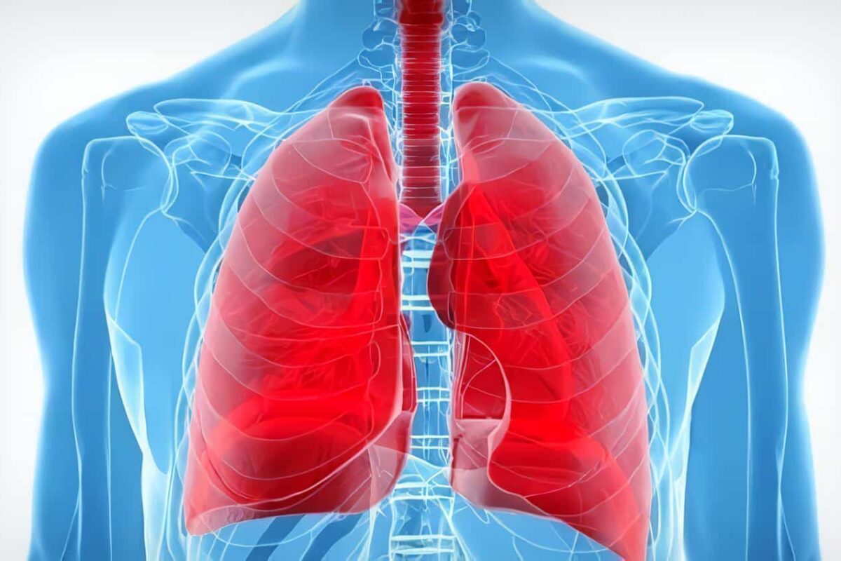 Derrame Pleural