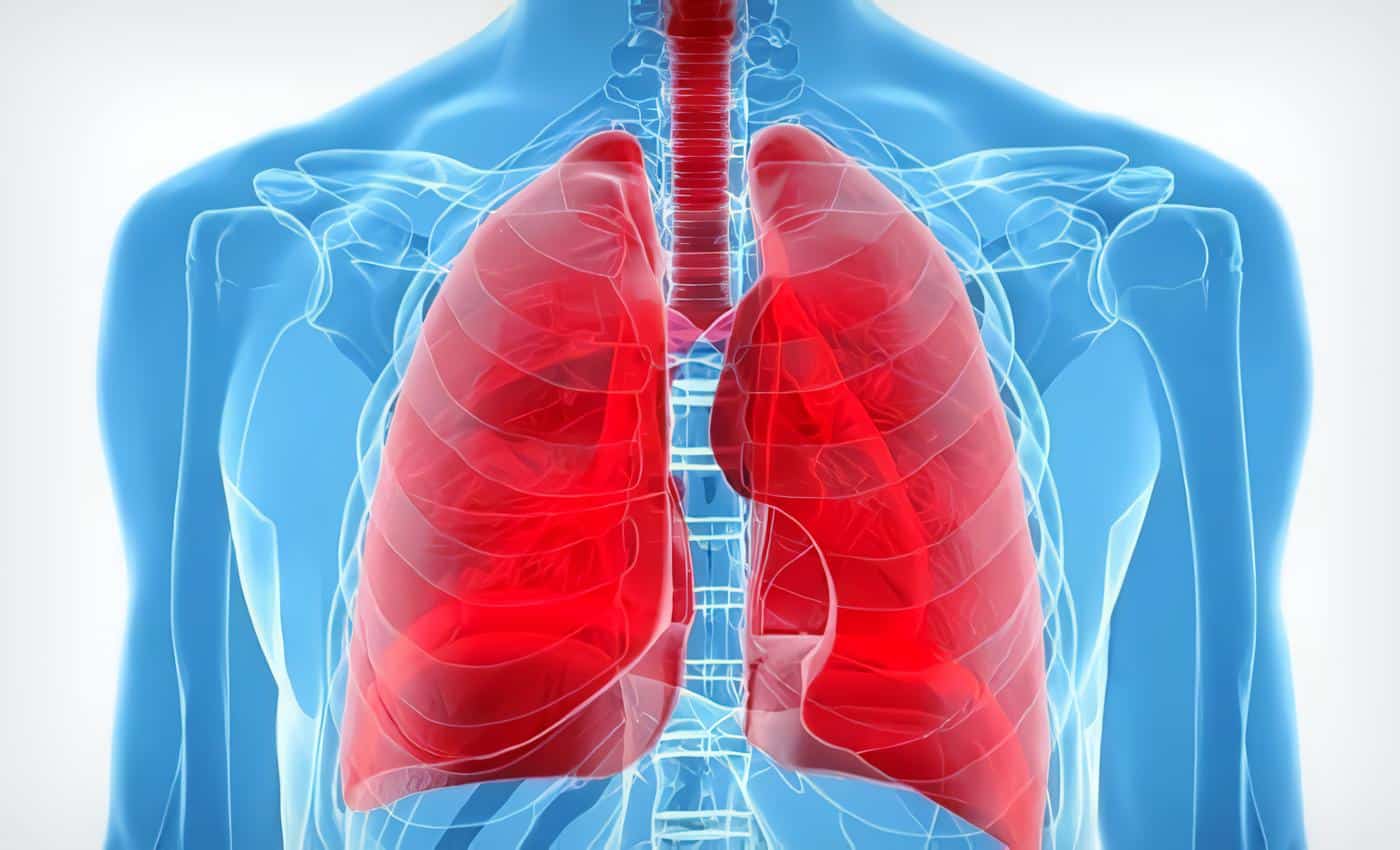 Derrame Pleural